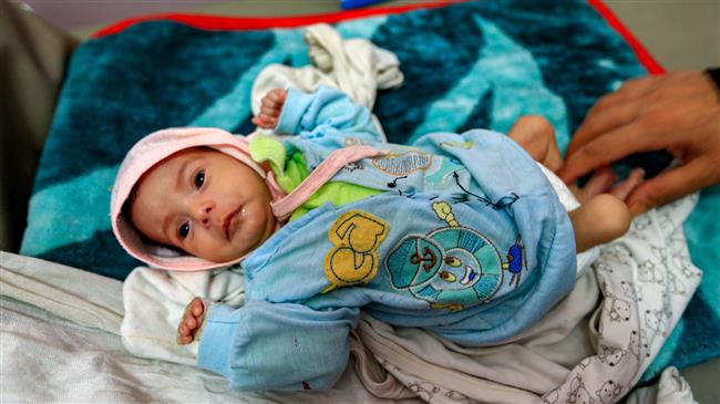 50, 000 children die every year in Yemen: Ansarullah
