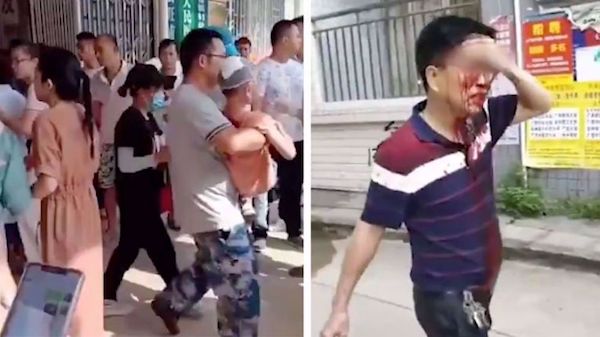 Knife attack wounds 39 in Chinese primary school