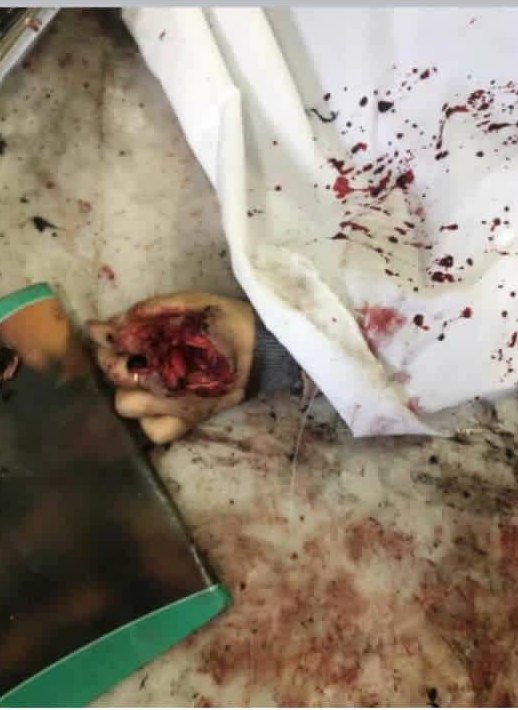 #داعش