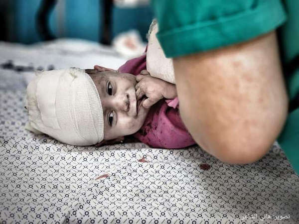 Photos Children and teenagers are the main victims of Gaza bombing