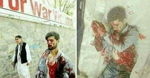 یک جوان افغان با پای خود تا درب شفاخانه رفت و جان داد
