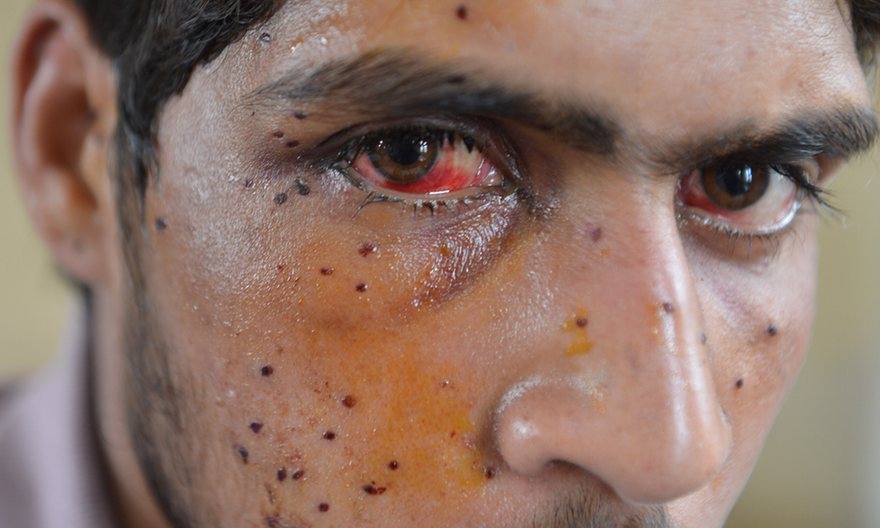 Indian Troops Clash with Kashmiri Protesters on Anniversary of Separatist Leader
