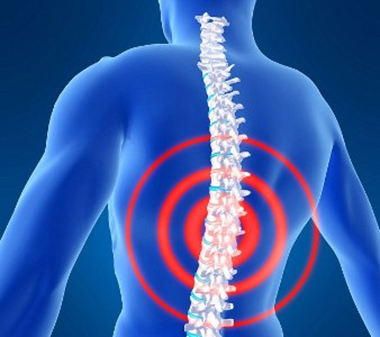 Report : Spinal implant helps a person with advanced Parkinsons disease walk without falling