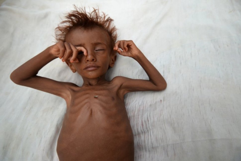 No Famine in Yemen but Over Half on the Brink: U.N.-Backed Report