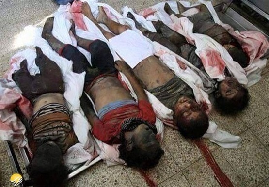تصاویری دلخراش از ۲ سال جنایات عربستان علیه ملت یمن