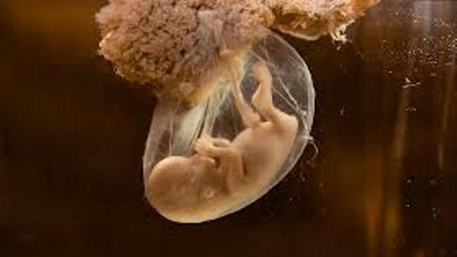  Scientists develop artificial womb for premature babies